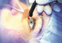 Основные виды лазерной коррекции зрения