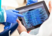 Реабилитация с использованием рентгеновских данных: ключевые моменты